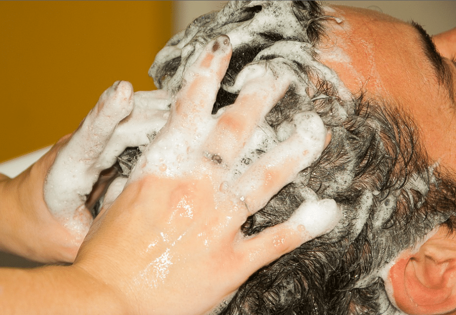 best dandruff shampoo-image from pixabay by jackmac347